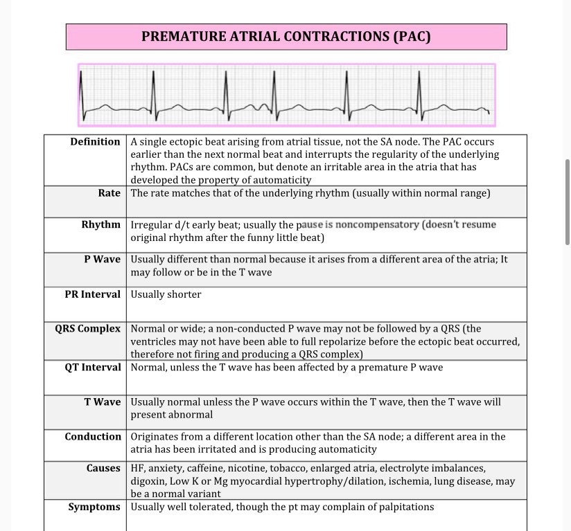 Cardiac Rhythm And Dysrhythmias Cheat Sheet Pages Long Etsy Hot Sex Picture