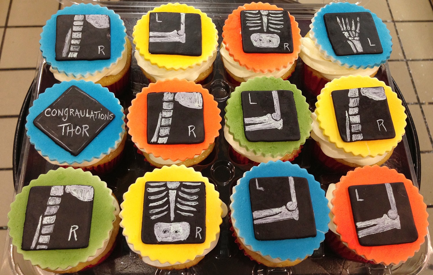 Xray Cupcake Toppers/party Favors 1 Dozen Etsy