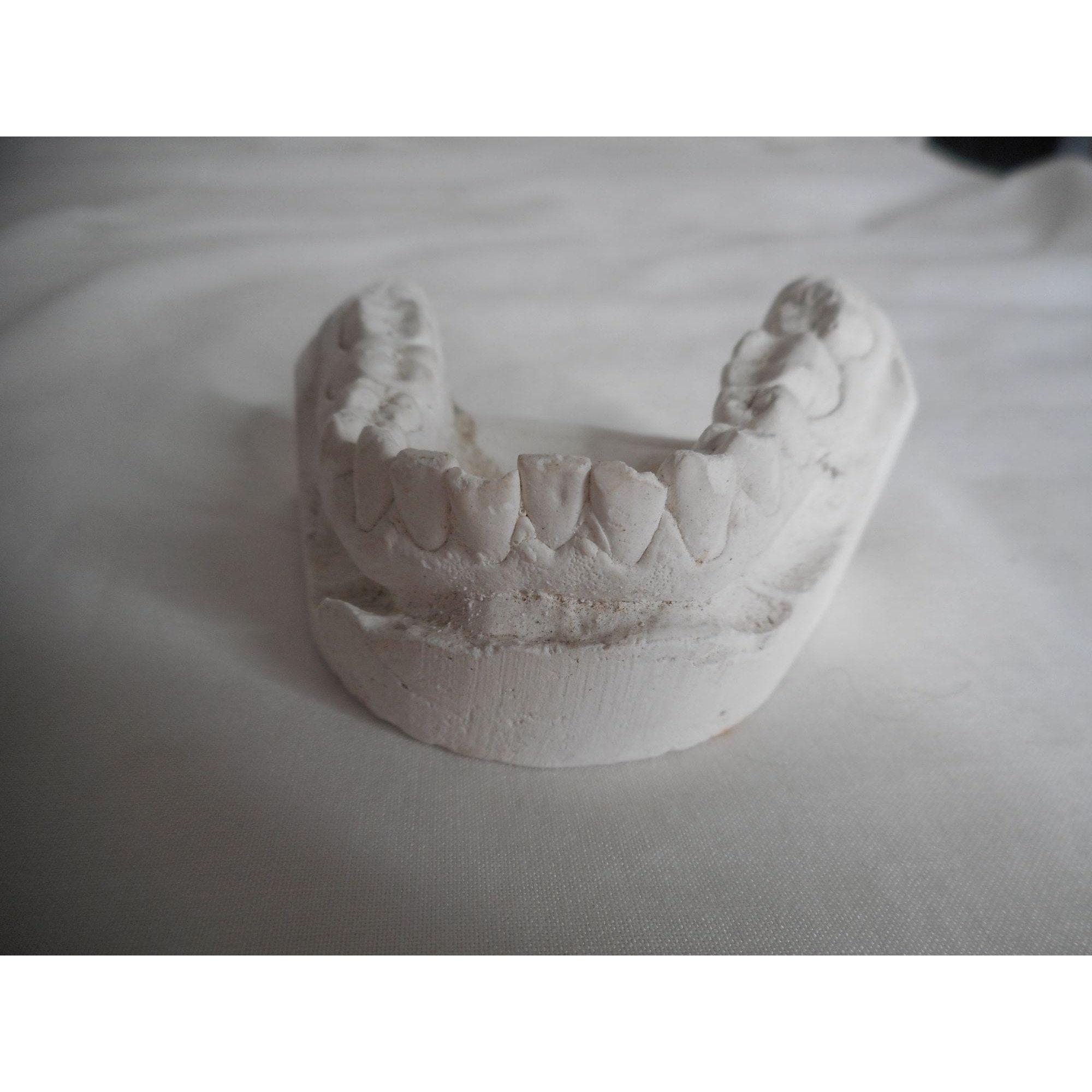 Vintage Cast Dental Teeth Mold Tooth Castings Medical Oddity 13 