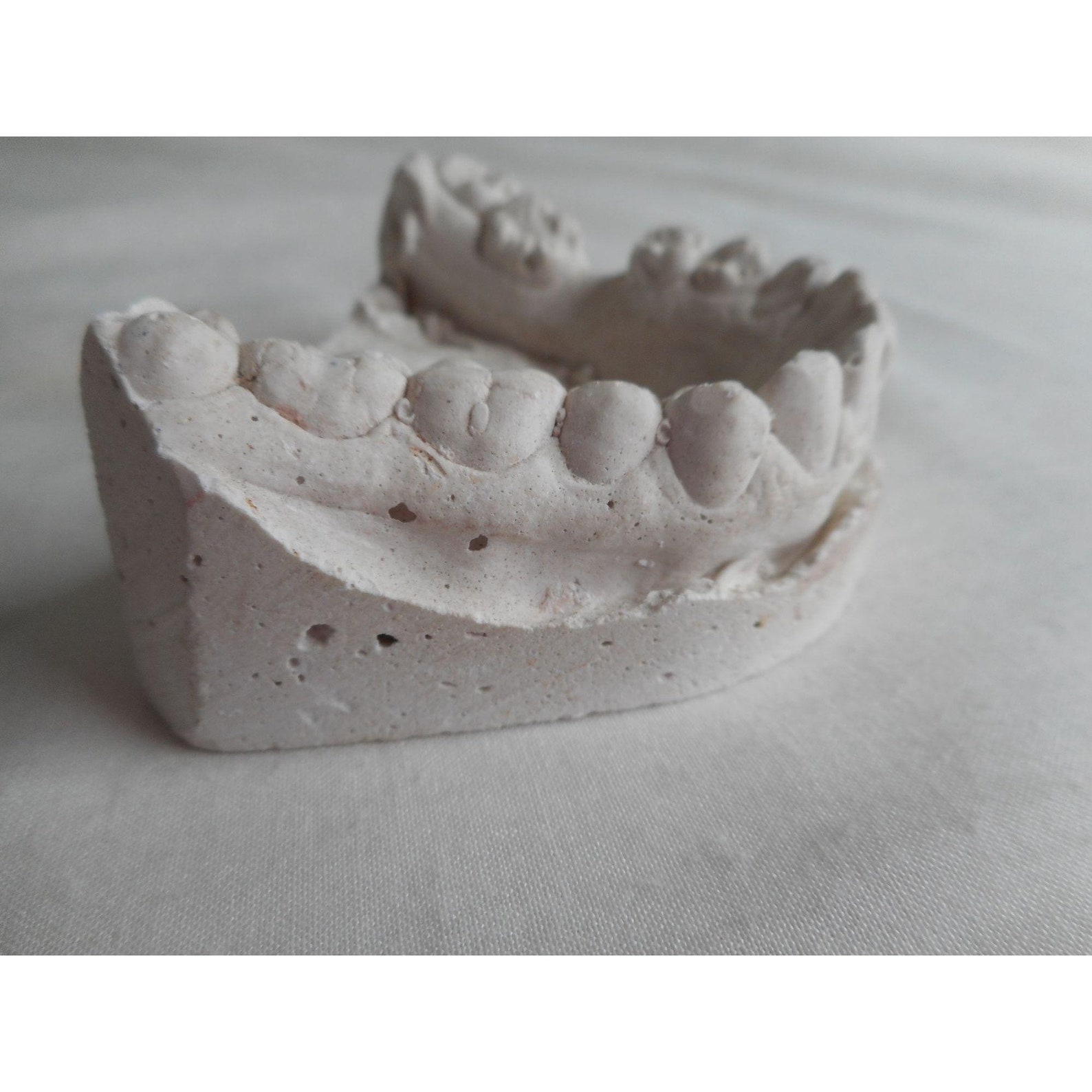 Vintage Cast Dental Teeth Mold Tooth Castings Medical Oddity Etsy UK
