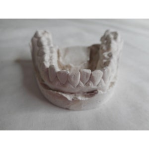 Vintage Cast Dental Teeth Mold  Tooth Castings Medical Oddity #13