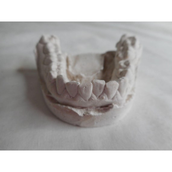 Vintage Cast Dental Teeth Mold Tooth Castings Medical Oddity 13 