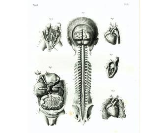 1854 Fetus, Foetus, Anatomical print XL, Anatomy Bourgery Victorian Wall Art 163 YEARS OLD