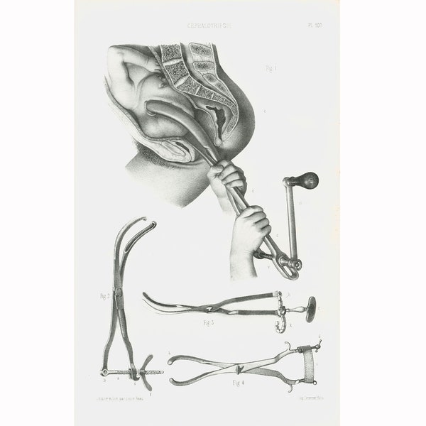 Midwife Tools - Etsy