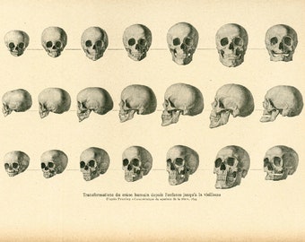 1908 Transformation of the human skull from childhood to old age Antique Human Skull Anatomy, Original Antique print, Medicine Wall Art