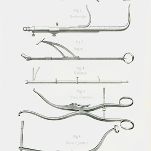 1865 Antique Obstetrical Tools Print, Pelvimeter, Midwife and ...