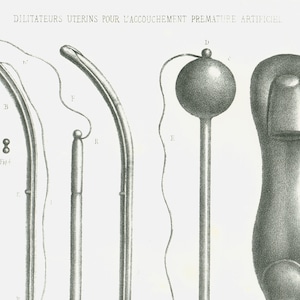 1865 Antique Obstetrical Tools Print, Pelvimeter, Midwife and ...