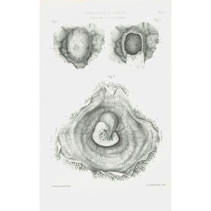 1865 Menselijke Embryogenese, Originele Anatomische Plaat Poster Anatomie Verloskunde Gynaecologie Embryologie