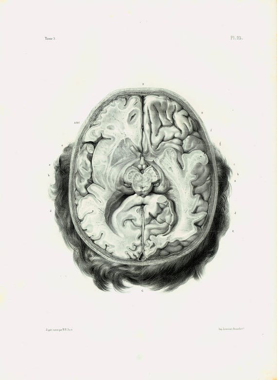 1844 Mózgu Człowieka Zabiegu Rysunek Anatomiczne Deska Bourgery Plakat Anatomia Medycyna Gabinet Osobliwości