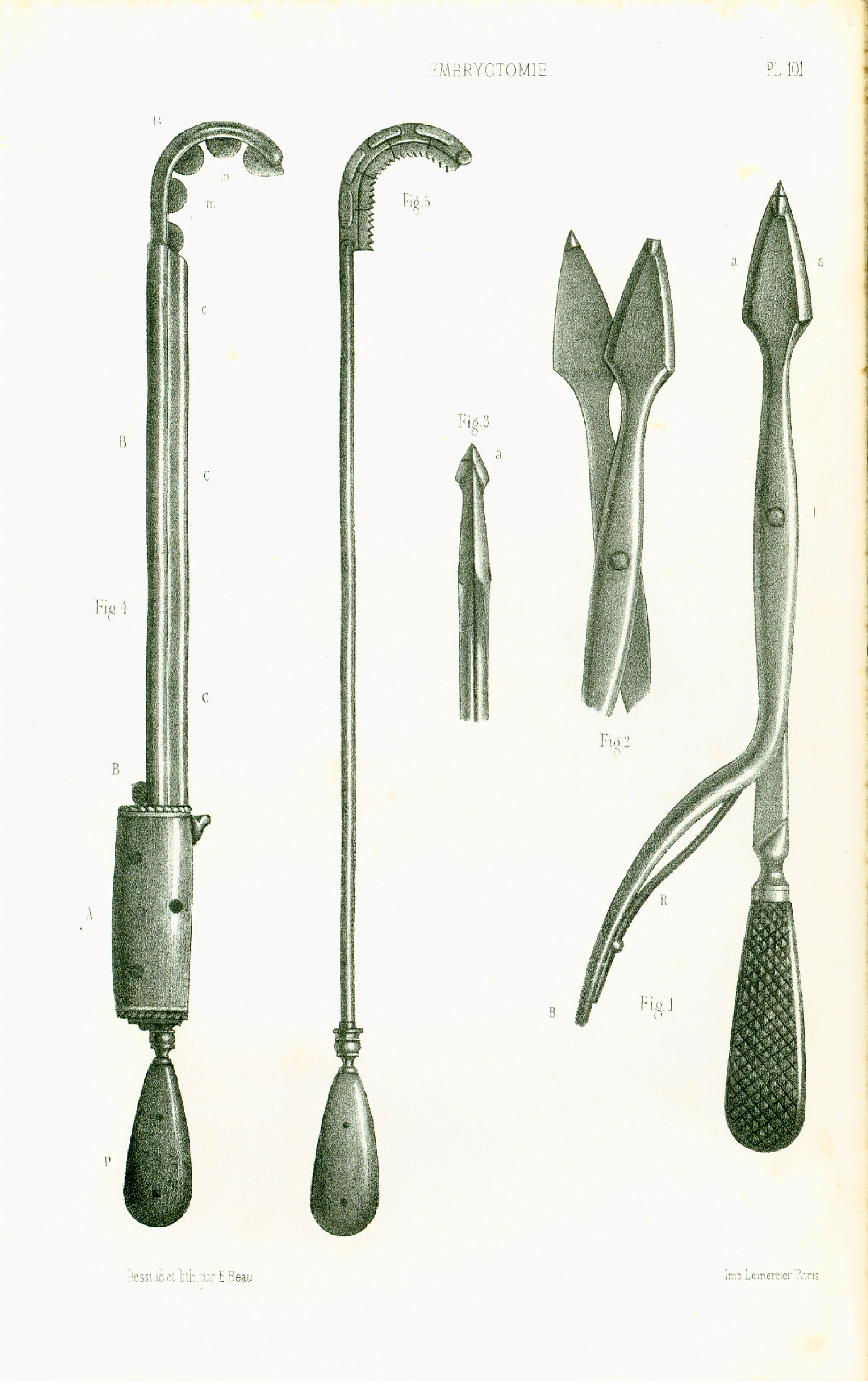 1865 Antique Obstetrical Tools Print, Pelvimeter, Midwife and ...