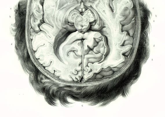 1844 Mózgu Człowieka Zabiegu Rysunek Anatomiczne Deska Bourgery Plakat Anatomia Medycyna Gabinet Osobliwości