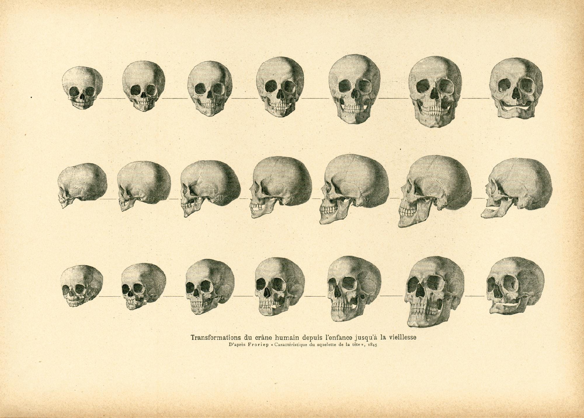 カパラ　ニンマ派の高僧のもの　1800年代初頭 頭蓋骨　アミュレット 1908年 幼少期から老年期までの人体頭蓋骨の変遷。20世紀初頭の原図