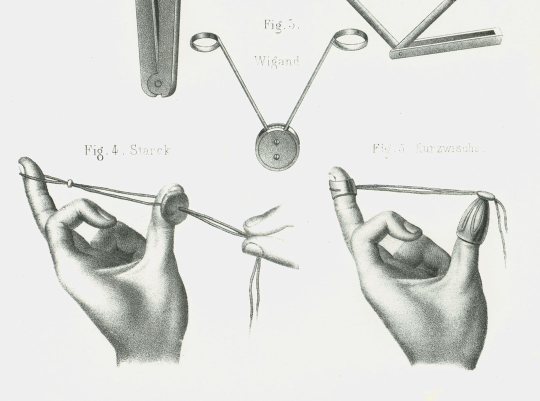 1865 Antique Obstetrical Tools Print, Midwife and Obstetrics Doctor ...