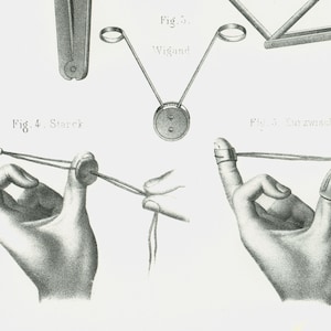 1865 Oude Instrumenten Gynaecologie Verloskunde Bevalling Originele Raad, Poster Anatomie Verloskunde Gynaecologie Embryologie