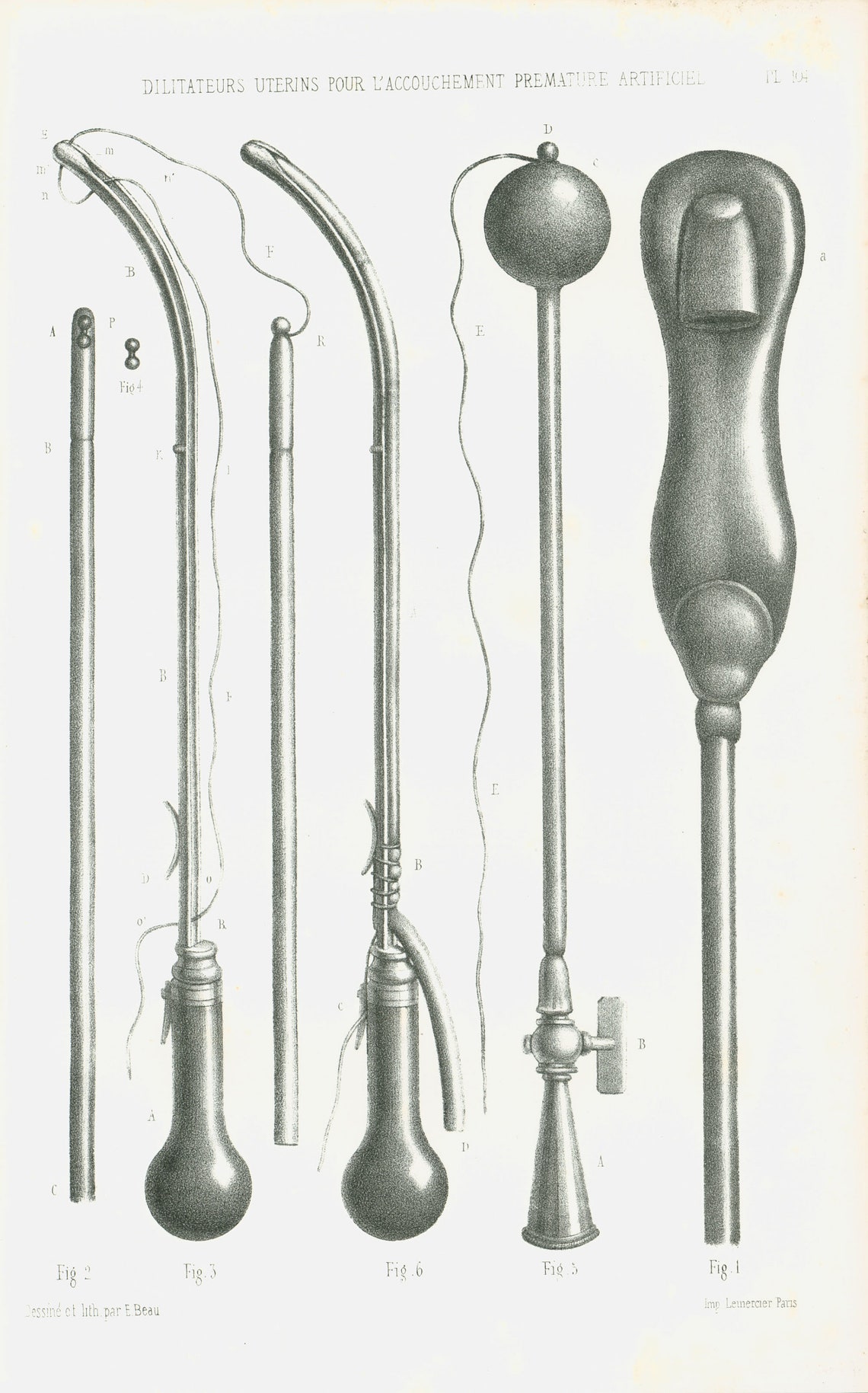 1865 Antique Obstetrical Tools Print Pelvimeter Midwife and - Etsy
