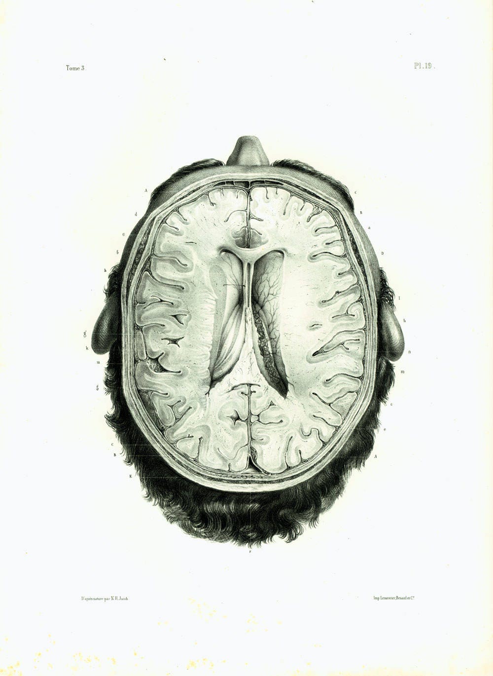 1844 XL Antique Brain Print, Human Skull, Brain Anatomy Poster Bourgery ...
