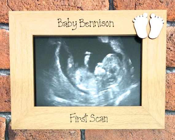 White Wooden Photo Frame Plaque Ultrasound Baby Scan Picture Newborn Gift