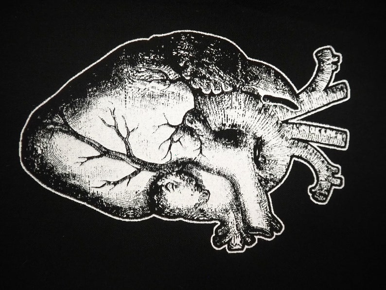 May include: A black and white anatomical illustration of a human heart. The heart is shown in detail, with the chambers, valves, and major blood vessels visible.