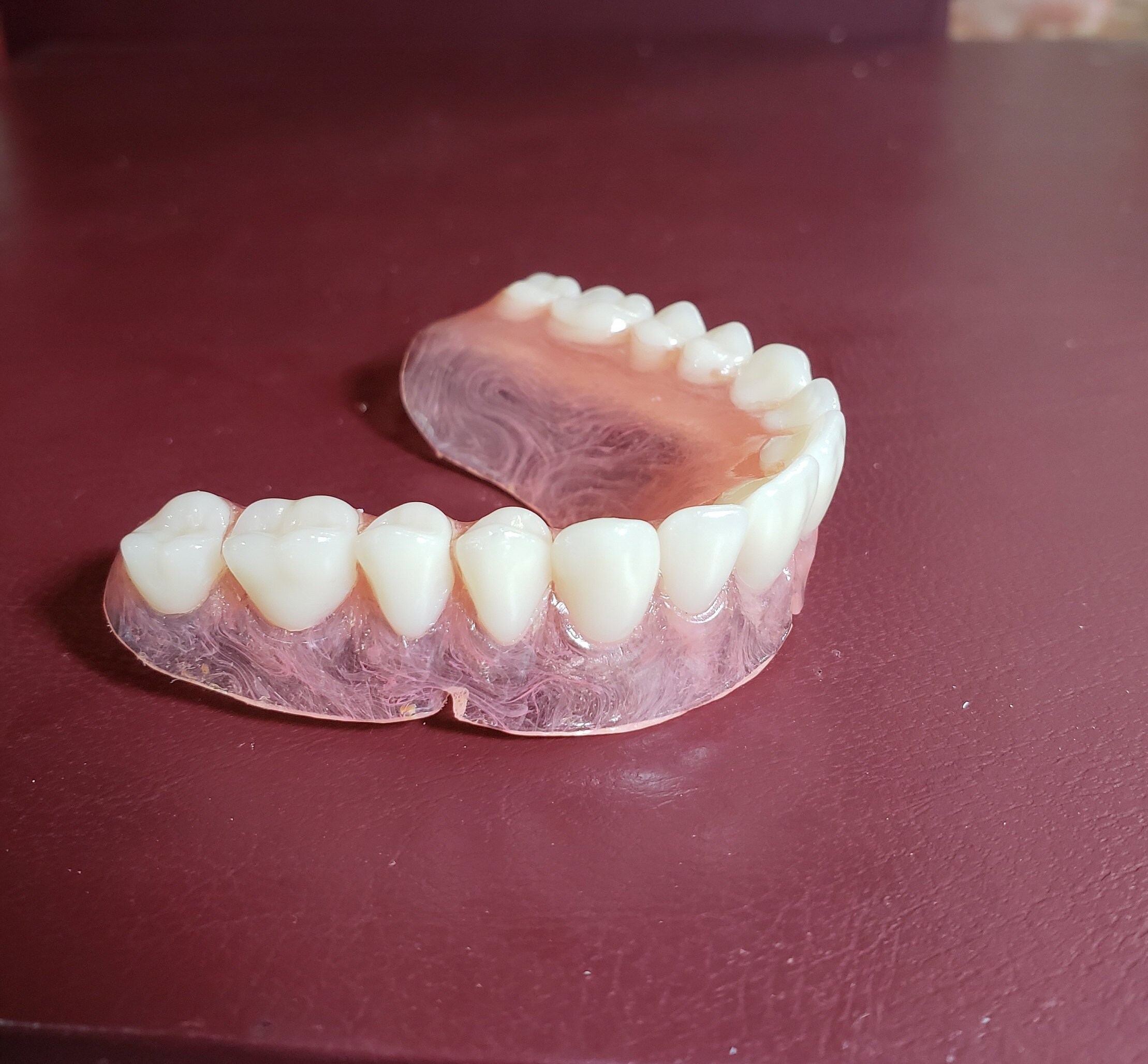 Horseshoe Upper Dentures Without Implantsprivacy - lz7s998