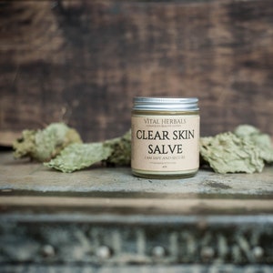 Clear skin salve - acne treatment - face salve - face cream - blemish balm - acne scar