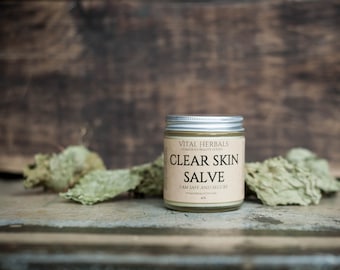 Clear skin salve - acne treatment - face salve - face cream - blemish balm - acne scar