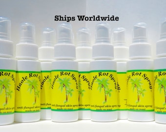 Natural Tinea Versicolor treatment, 100% Money Back Guarantee! Topical Tinea Versicolor Cure, Haole Rot Spray