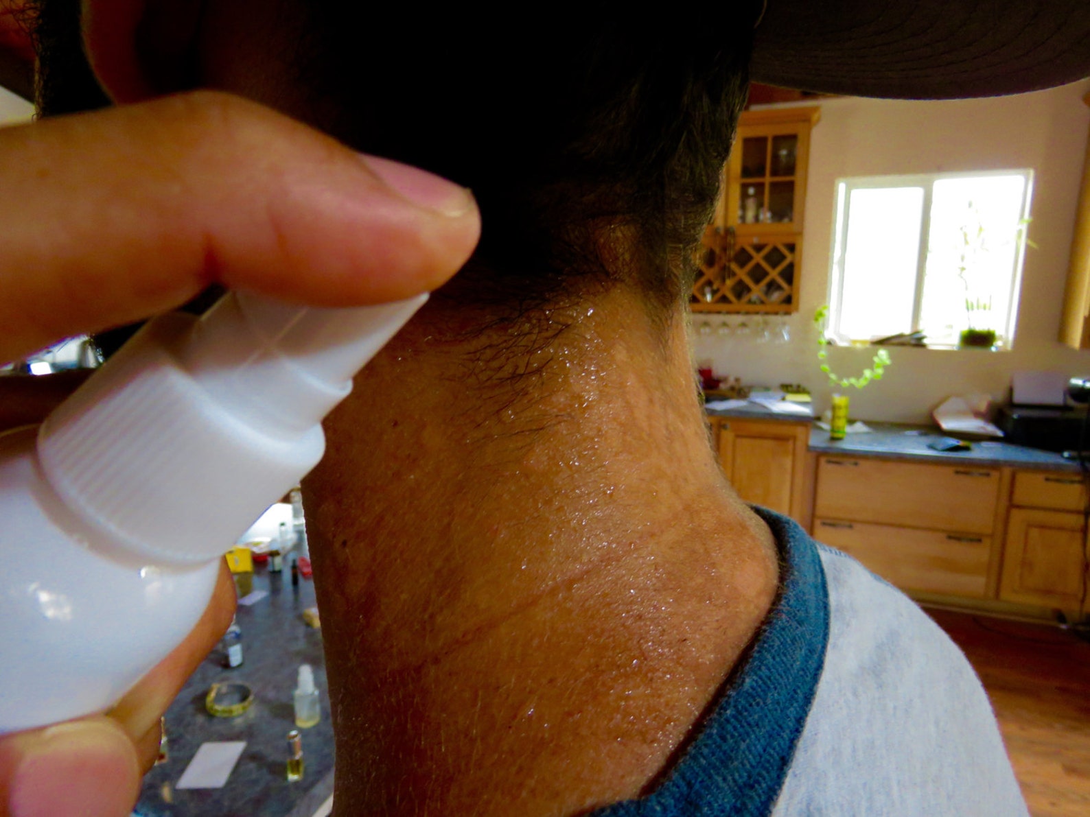 Home Tinea Versicolor Treatment Natural Tinea Versicolor Etsy UK