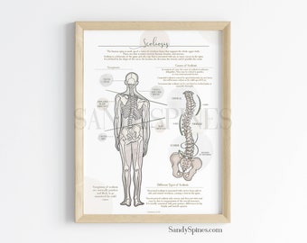 Scoliosis Anatomy Poster | SANDYSPINES |Art for Chiropractors, physical therapists, Osteopaths and More