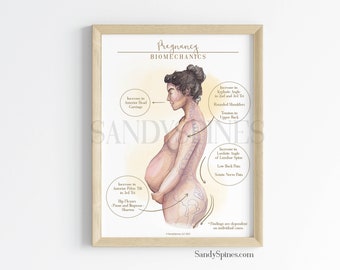 Biomechanics of Pregnancy Poster | SANDYSPINES | art for health professions, osteopaths, chiropractors, physical therapists