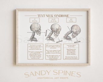 Text Neck Syndrome Poster | SANDYSPINES | Art for medical professionals, chiropractors, physical therapists, osteopaths