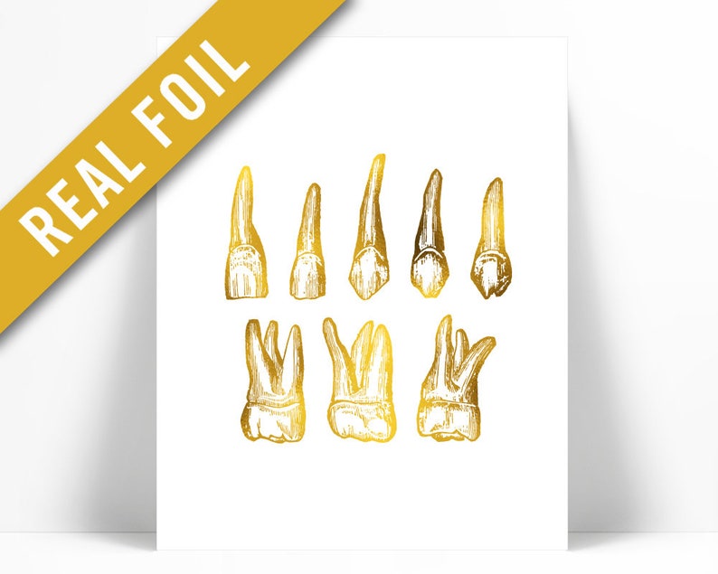 Human Teeth Gold Foil Print Dental Office Wall Art Anatomy Etsy