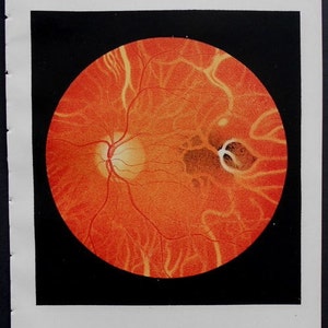 1854 Set of 8 color lithographs: eye anatomy under an opthalmoscope Augenspiegel Drawn by Dr. Eduard Jaeger. Extremely Scarce. image 3