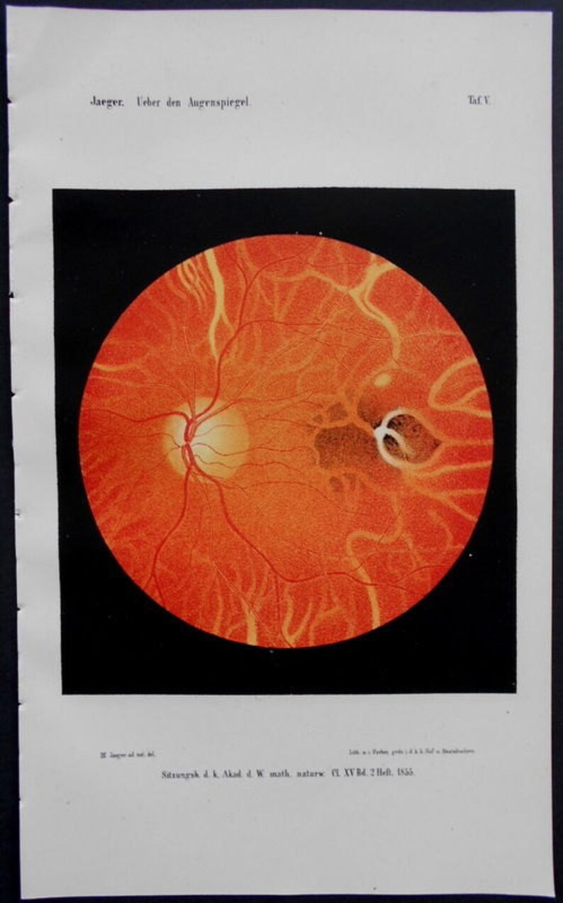 1854 Set of 8 color lithographs: eye anatomy under an opthalmoscope Augenspiegel Drawn by Dr. Eduard Jaeger. Extremely Scarce. image 3