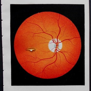 1854 Set of 8 color lithographs: eye anatomy under an opthalmoscope Augenspiegel Drawn by Dr. Eduard Jaeger. Extremely Scarce. image 2