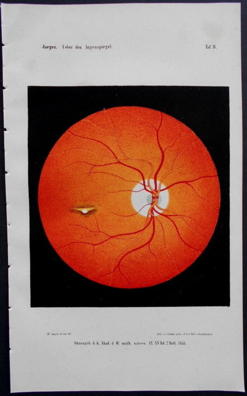 1854 Set of 8 color lithographs: eye anatomy under an opthalmoscope Augenspiegel Drawn by Dr. Eduard Jaeger. Extremely Scarce. image 2