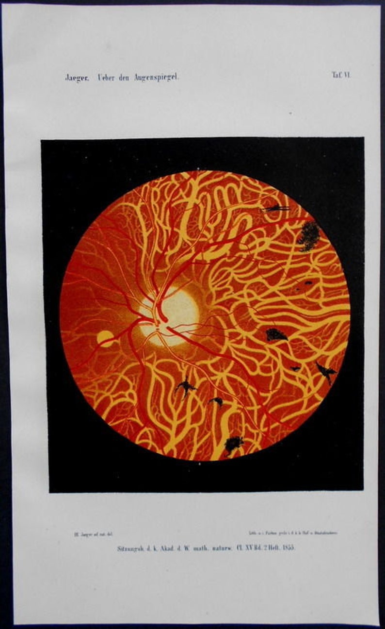 1854 Set of 8 color lithographs: eye anatomy under an opthalmoscope Augenspiegel Drawn by Dr. Eduard Jaeger. Extremely Scarce. image 5