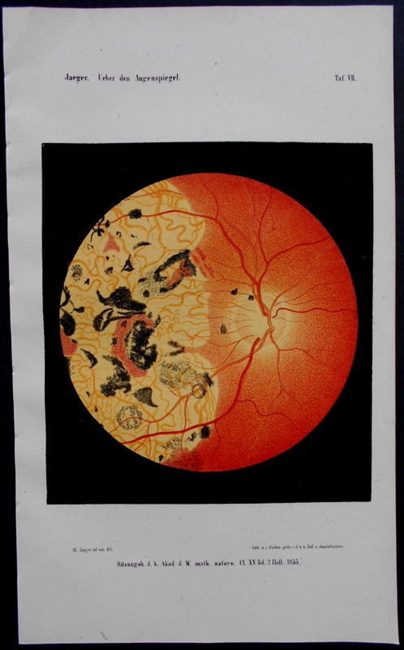 1854 Set of 8 color lithographs: eye anatomy under an opthalmoscope Augenspiegel Drawn by Dr. Eduard Jaeger. Extremely Scarce. image 4