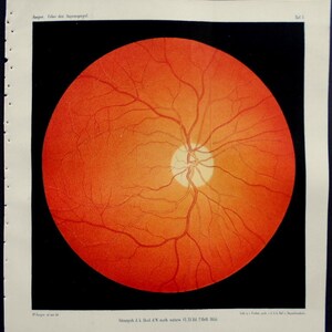 1854 Set of 8 color lithographs: eye anatomy under an opthalmoscope Augenspiegel Drawn by Dr. Eduard Jaeger. Extremely Scarce. image 1