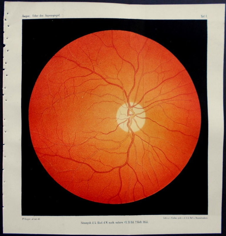 1854 Set of 8 color lithographs: eye anatomy under an opthalmoscope Augenspiegel Drawn by Dr. Eduard Jaeger. Extremely Scarce. image 1