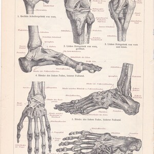 1896 Ligaments of the Human Body Antique Lithograph Print, Anatomy ...