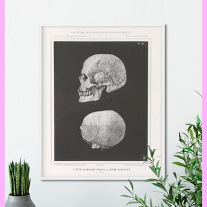 Skull - Anatomy print - Medical - Vintage - Antique - Black and White - Printable - Decor - WALL ART - Digital Download