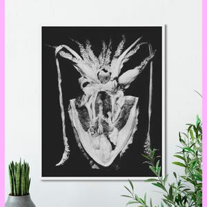 Squid - Anatomy print - Medical - Vintage - Antique - Black and White - Printable - Decor - WALL ART - Digital Download