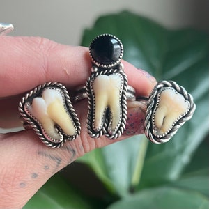 Your Own Custom Tooth Ring!
