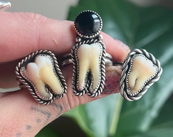 Your Own Custom Tooth Ring!