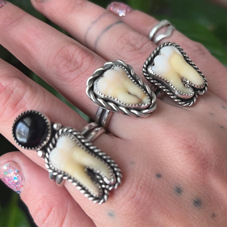 Your Own Custom Tooth Ring Etsy