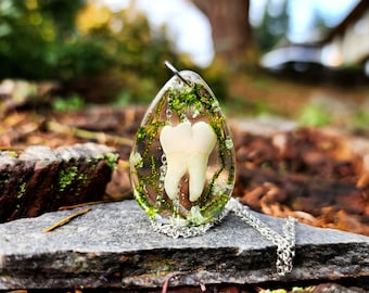 Édition limitée, De vraies dents, Dents, De vraies dents d'animaux, Cadeau, Bouchons dentaires, Collier, Pendentif, Résine, Dents, Bizarreries, Vertèbres, Bijoux, Os