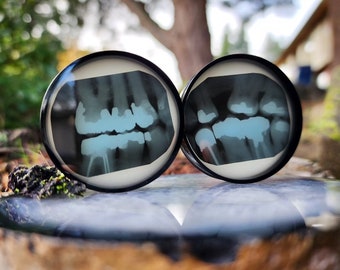 X-Ray plugs, Dental X-Ray, X-Ray, Dental, Resin Plugs, Set of plugs, Ear gauges, Oddities Plugs, Gauges, Teeth, Tooth, Bones,Limited Edition