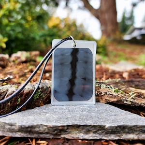 May include: A black and white dental x-ray image encased in clear plastic with a black cord attached. The x-ray is hanging from a rock.