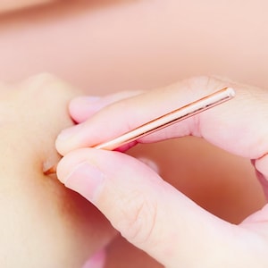 May include: A close-up of a person's hand holding a rose gold acupuncture needle. The needle is being used to stimulate a pressure point on the person's arm.