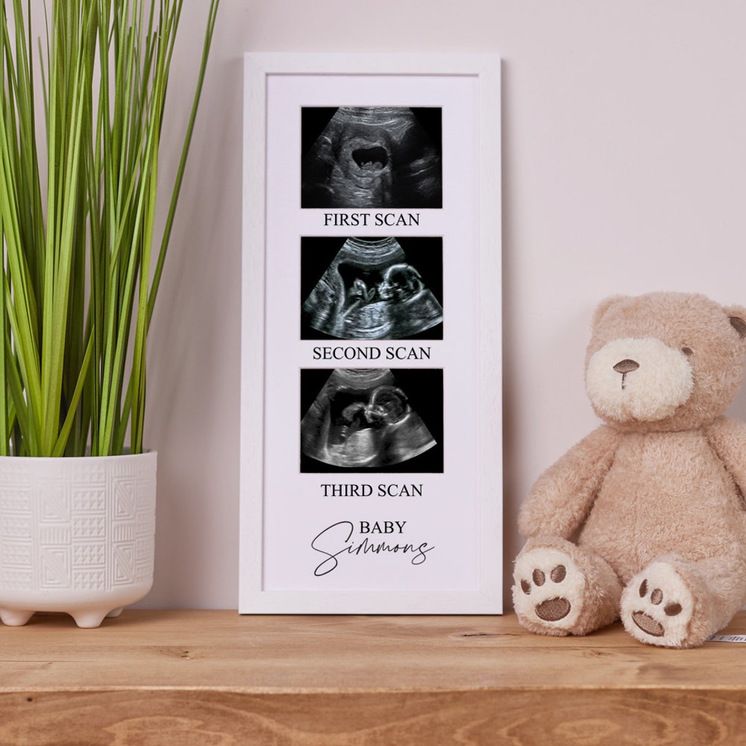 Personalised Baby Scan Photo Frame With Multi Aperture Three Photos Etsy